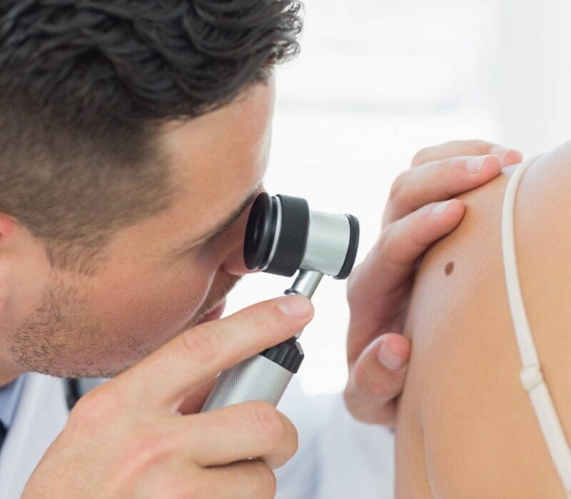 Doctor checking patient for skin cancers